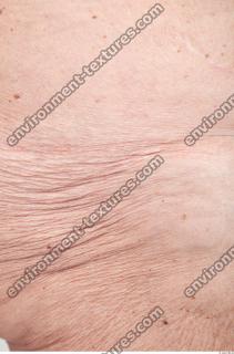 photo texture of wrinkled skin 0001
